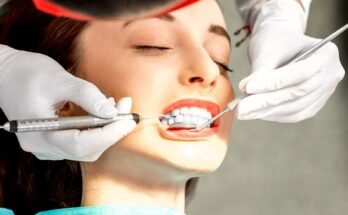 Teeth cleaning in Ancaster